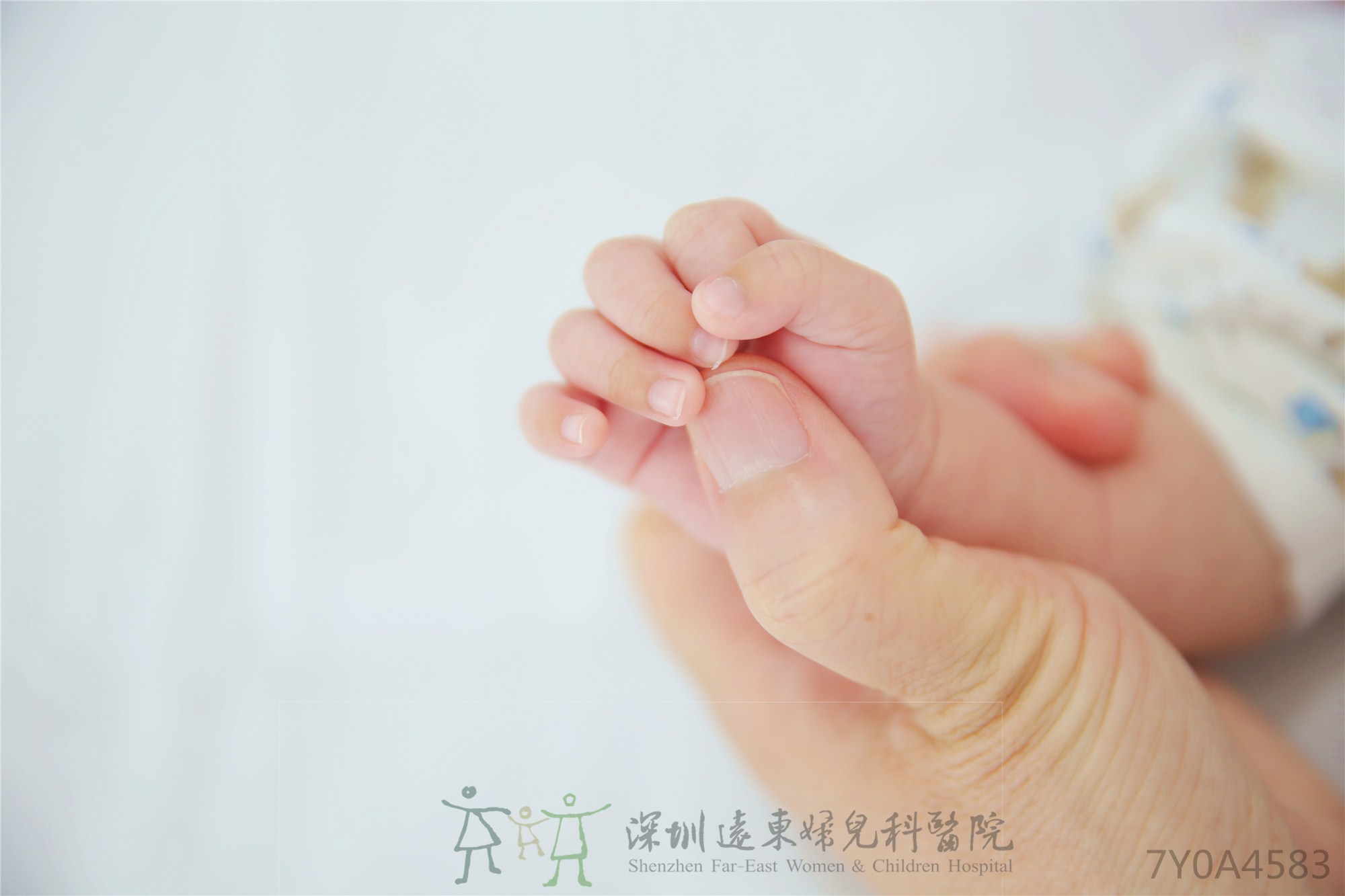 “断掌”是唐氏儿的表现？两处体貌特征暗示患病，预防从怀孕抓起_胎儿