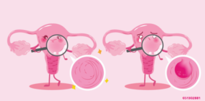 备孕遭遇反复流产？如何才能拥有好“孕”气？